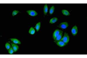 Immunofluorescence staining of A549 cells with ABIN7150721 at 1:200, counter-stained with DAPI. (MAP2K6 抗体  (AA 1-334))
