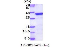 SDS-PAGE (SDS) image for Protein Phosphatase, Mg2+/Mn2+ Dependent, 1D (PPM1D) (AA 98-375) protein (His tag) (ABIN5854111)