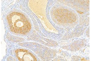 ABIN6259721 and ABIN6269341 at 1/100 staining Rat ovary tissue by IHC-P.