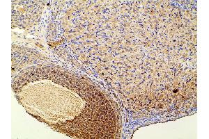 Immunohistochemistry (IHC) image for anti-Phosphoinositide 3 Kinase, p85 alpha (PI3K p85a) (pTyr607) antibody (ABIN6256775)