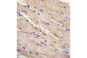 Immunohistochemistry (Paraffin-embedded Sections) (IHC (p)) image for anti-Family with Sequence Similarity 69, Member B (FAM69B) (AA 114-144), (N-Term) antibody (ABIN952241)
