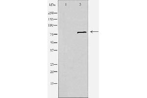 Western blot analysis of extracts from Jurkat cells, using SLC6A15 antibody. (SLC6A15 抗体  (N-Term))