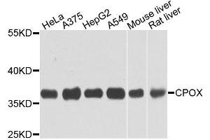 Western Blotting (WB) image for anti-Coproporphyrinogen Oxidase (CPOX) (AA 111-454) antibody (ABIN1679346)