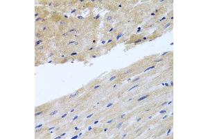 Immunohistochemistry of paraffin-embedded rat heart using RAB24 antibody at dilution of 1:100 (x40 lens). (RAB24 抗体)