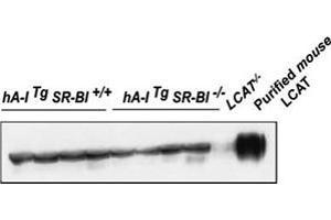 Western blot analysis of plasma LCAT protein mass using Lcat polyclonal antibody . (LCAT 抗体)