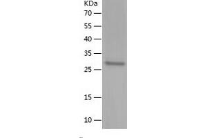 UHRF1 Protein (AA 96-297) (His tag)