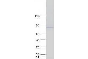 Validation with Western Blot (TXNIP Protein (Myc-DYKDDDDK Tag))