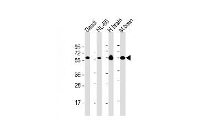 All lanes : Anti-CSIN2 Antibody at 1:2000 dilution Lane 1: Daudi whole cell lysate Lane 2: HL-60 whole cell lysate Lane 3: human brain lysate Lane 4: mouse brain lysate Lysates/proteins at 20 μg per lane.
