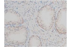 ABIN6267395 at 1/200 staining Human prostate tissue sections by IHC-P. (GATA1 抗体  (pSer142))