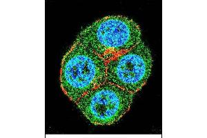 Confocal immunofluorescent analysis of BTRC Antibody (N-term) (ABIN655814 and ABIN2845238) with ZR-75-1 cell followed by Alexa Fluor 488-conjugated goat anti-rabbit lgG (green). (BTRC 抗体  (N-Term))