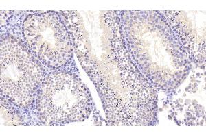 Detection of NEIL3 in Mouse Testis Tissue using Polyclonal Antibody to Nei Endonuclease VIII Like Protein 3 (NEIL3) (NEIL3 抗体  (AA 2-187))