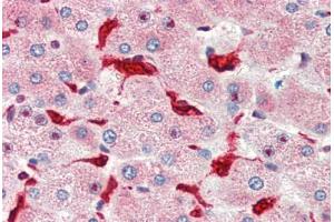 Human Liver (formalin-fixed, paraffin-embedded) stained with HMOX1 antibody ABIN462108 at 10 ug/ml followed by biotinylated goat anti-rabbit IgG secondary antibody ABIN481713, alkaline phosphatase-streptavidin and chromogen.