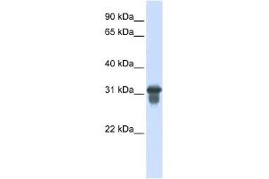 SLC25A11 antibody used at 1 ug/ml to detect target protein.