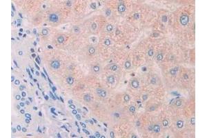 Detection of PROS in Human Liver Tissue using Polyclonal Antibody to Protein S (PROS) (PROS1 抗体  (AA 481-667))