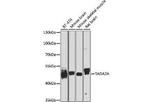 Western blot analysis of extracts of various cell lines using TADA2A Polyclonal Antibody at dilution of 1:1000. (TADA2L 抗体)