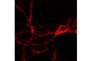 Indirect immunofluorescence labeling of PFA fixed rat hippocampus neurons (dilution 1 : 500). (SNAP91 抗体  (AA 279-297))