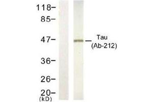 Image no. 1 for anti-Microtubule-Associated Protein tau (MAPT) (Thr212) antibody (ABIN197504) (MAPT 抗体  (Thr212))