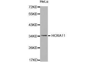 Western Blotting (WB) image for anti-Homeobox A11 (HOXA11) antibody (ABIN1873073) (Homeobox A11 抗体)