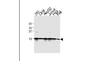 Western blot analysis of lysates from 293, CEM, HepG2, Jurkat, Hela, Raji cell line(from left to right).