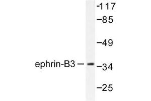 Image no. 1 for anti-Ephrin B3 (EFNB3) antibody (ABIN265403) (Ephrin B3 抗体)