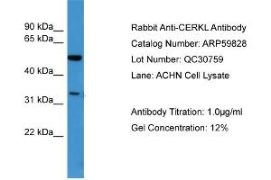 WB Suggested Anti-CERKL  Antibody Titration: 0. (CERKL 抗体  (N-Term))