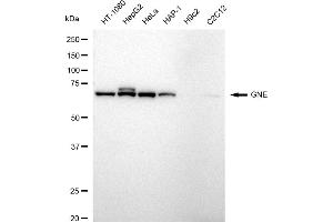 Western blotting analysis using GNE antibody (ABIN7798730).