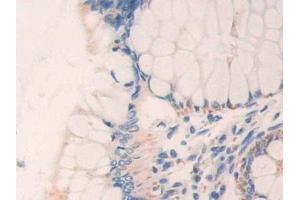 Immunohistochemistry (IHC) image for anti-Electron-Transfer-Flavoprotein, beta Polypeptide (ETFB) (AA 2-255) antibody (ABIN7440638)