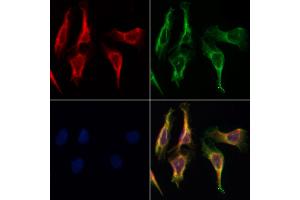 ABIN6258273 and ABIN6274214 staining Hela by IF/ICC.