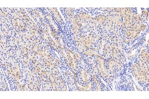 Detection of Slit2 in Human Kidney Tissue using Polyclonal Antibody to Slit Homolog 2 (Slit2) (SLIT2 抗体  (AA 664-777))