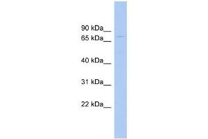 RAD17 antibody used at 1 ug/ml to detect target protein. (RAD17 抗体)