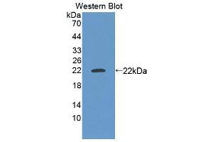 Western blot analysis of the recombinant protein. (MEF2A 抗体  (AA 1-162))
