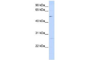 PPM1M antibody used at 1 ug/ml to detect target protein. (PPM1M 抗体)