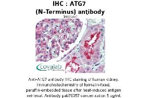 Image no. 1 for anti-ATG7 Autophagy Related 7 (ATG7) (N-Term) antibody (ABIN1732022) (ATG7 抗体  (N-Term))