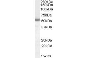 ABIN334449 (0. (NOVA1 抗体  (Internal Region))