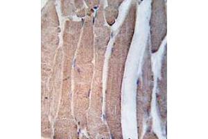 Formalin-fixed and paraffin-embedded human skeletal muscle tissue reacted with DAPK2 Antibody (N-term) , which was peroxidase-conjugated to the secondary antibody, followed by DAB staining. (DAPK2 抗体  (N-Term))