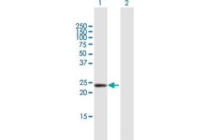 Western Blot analysis of DMRTB1 expression in transfected 293T cell line by DMRTB1 MaxPab polyclonal antibody. (DMRTB1 抗体  (AA 1-189))