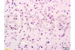Formalin-fixed and paraffin embedded rat brain tissue labeled with Anti-SMURF2 Polyclonal Antibody, Unconjugated (ABIN753178) at 1:200 followed by conjugation to the secondary antibody, (SP-0023), and DAB staining (SMURF2 抗体  (AA 601-700))