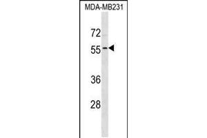 Western blot analysis in MDA-MB231 cell line lysates (35ug/lane).