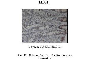 Sample Type :  Pig stomach  Primary Antibody Dilution :  1:200  Secondary Antibody :  Anti-rabbit-HRP  Secondary Antibody Dilution :  1:1000  Color/Signal Descriptions :  Brown: MUC1 Blue: Nucleus  Gene Name :  MUC1  Submitted by :  Dr. (MUC1 抗体  (Middle Region))