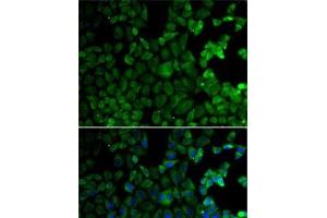 Immunofluorescence analysis of HeLa cells using MSR1 Polyclonal Antibody (Macrophage Scavenger Receptor 1 抗体)