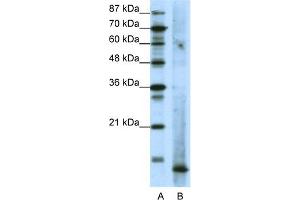 WB Suggested Anti-MDS1 Antibody Titration:  1. (MECOM 抗体  (N-Term))