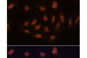 Immunofluorescence analysis of U-2 OS cells using SNIP1 Polyclonal Antibody at dilution of 1:100. (SNIP1 抗体)