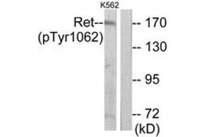 Western blot analysis of extracts from K562 cells, using Ret (Phospho-Tyr1062) Antibody. (Ret Proto-Oncogene 抗体  (pTyr1062))