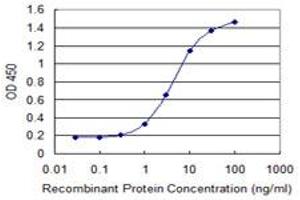 Detection limit for recombinant GST tagged PLEC1 is 0. (PLEC 抗体  (AA 4384-4493))