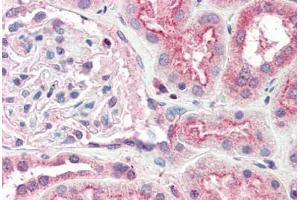 Human Kidney (formalin-fixed, paraffin-embedded) stained with OGG1 antibody ABIN337126 at 2. (OGG1 抗体  (AA 282-297))