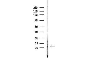Western blot analysis of lysates from HepG2 cells(LPS, 4h treatment), using RHOXF1 Antibody at 1/1000 dilution.