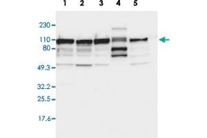 Western blot analysis of Lane 1: RT-4, Lane 2: U-251 MG, Lane 3: A-431, Lane 4: Liver, Lane 5: Tonsil with CTAGE5 polyclonal antibody .