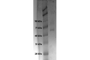 Recombinant p53 protein analyzed by SDS-PAGE gel.