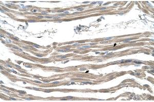 Immunohistochemistry (IHC) image for anti-Solute Carrier Family 25 (Mitochondrial Carrier: Glutamate), Member 22 (SLC25A22) (N-Term) antibody (ABIN2781686)