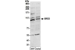 Western Blotting (WB) image for anti-Bromodomain Containing 2 (BRD2) (AA 550-600) antibody (ABIN7452921)